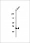 GLS Antibody (C-term)